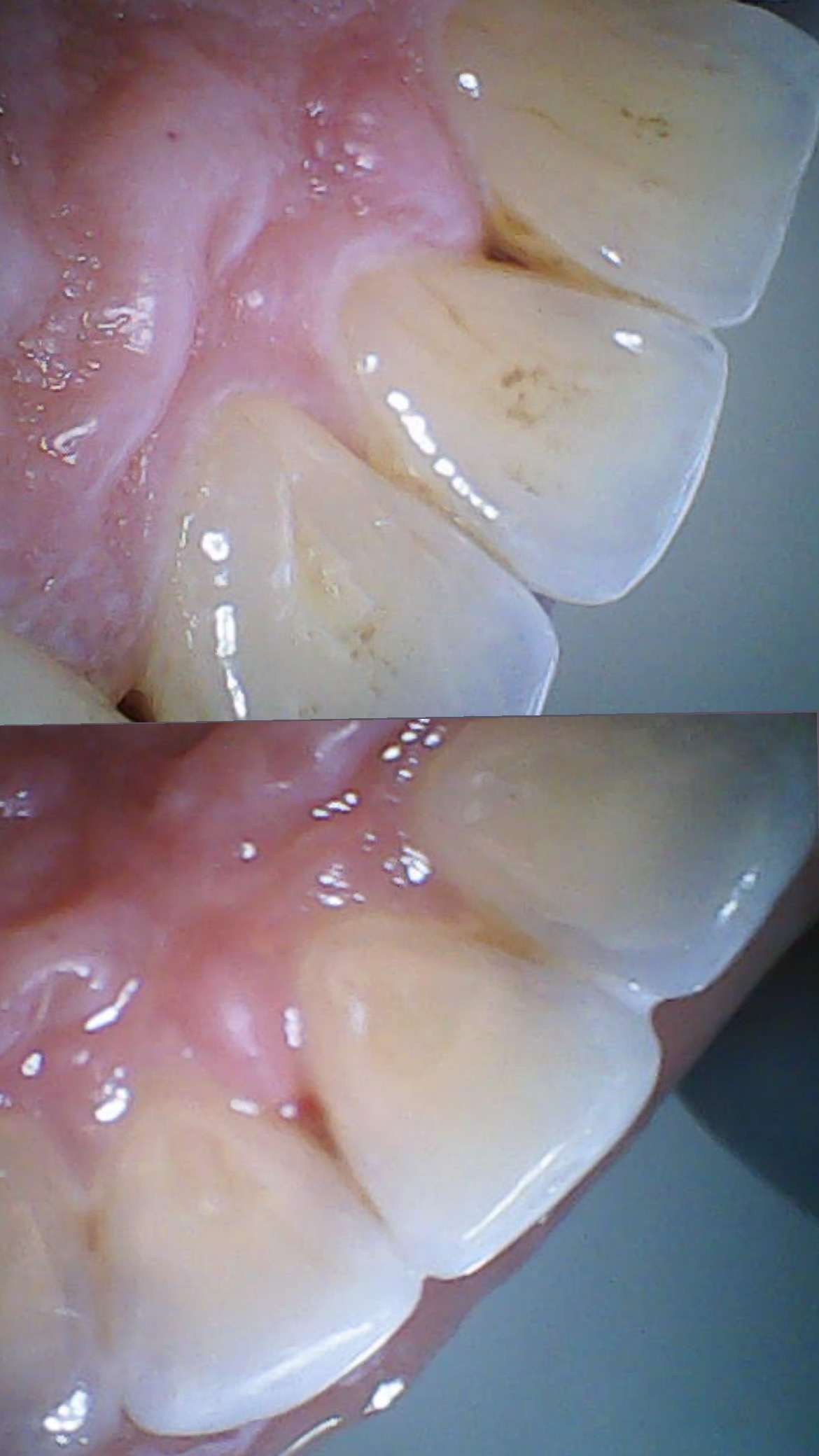 Foto 2 de Dra. Ana Flores odontologia integrada 