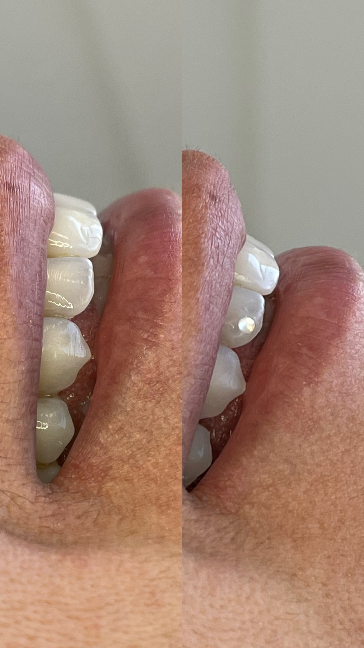 Foto 3 de Dra. Ana Flores odontologia integrada 