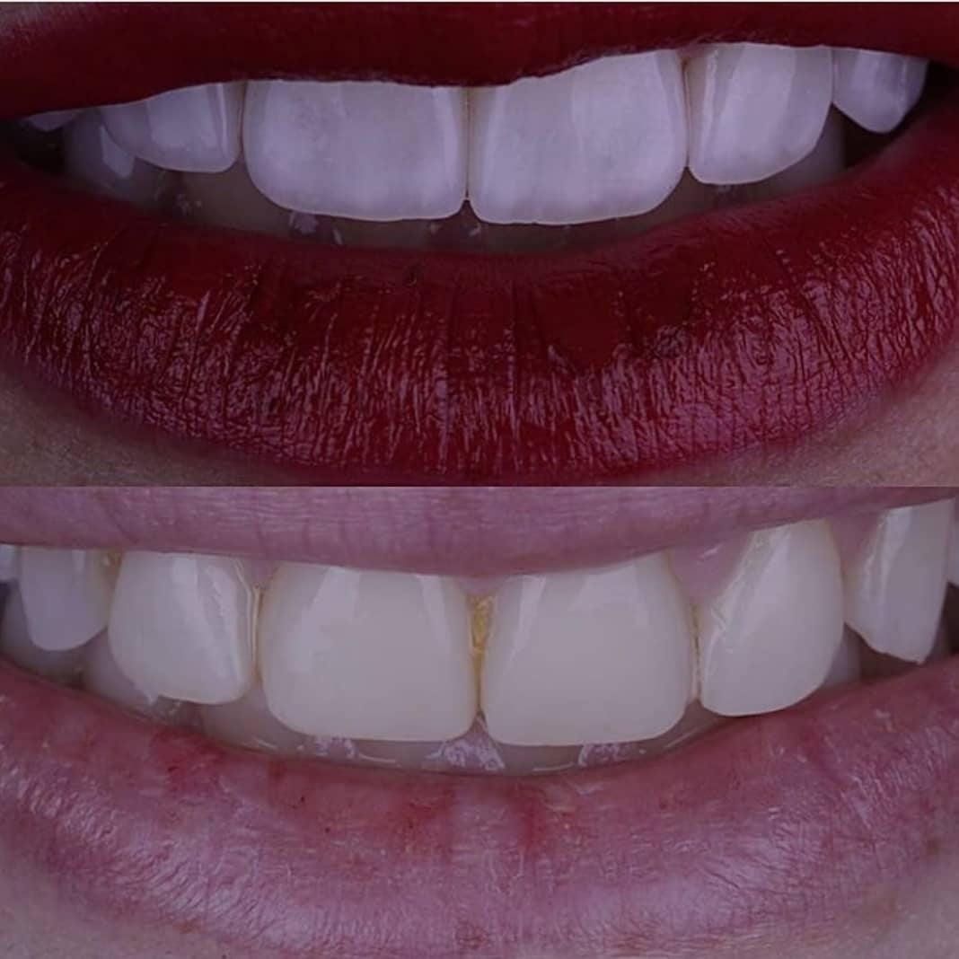 Foto principal de Ateliê dos Dentes by Dra. Luana Serralva - Referência em Implantes e Harmonização Facial 