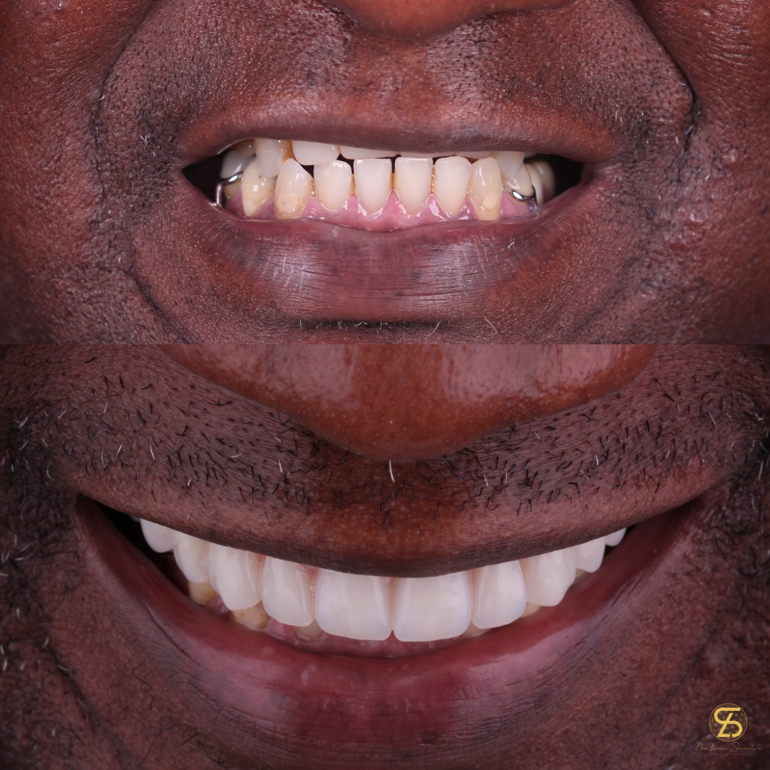 Foto 2 de Ateliê dos Dentes by Dra. Luana Serralva - Referência em Implantes e Harmonização Facial 