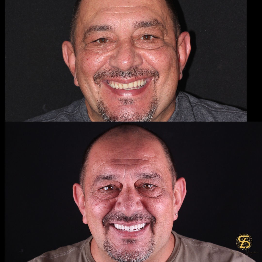 Foto 3 de Ateliê dos Dentes by Dra. Luana Serralva - Referência em Implantes e Harmonização Facial 