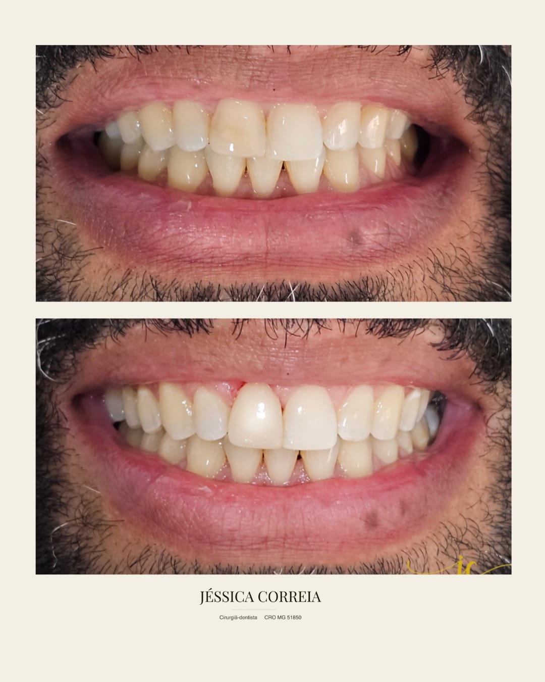 Foto 2 de Dra. Jéssica Correia | Cirurgiã Dentista