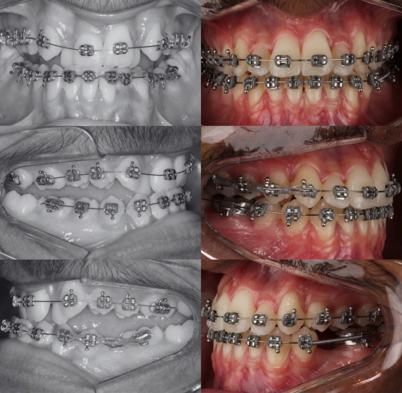 Foto 2 de Dr. Matheus Rios - Ortodontia e Alinhadores Invisíveis
