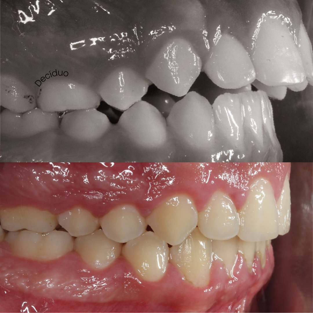Foto 3 de Dr. Matheus Rios - Ortodontia e Alinhadores Invisíveis