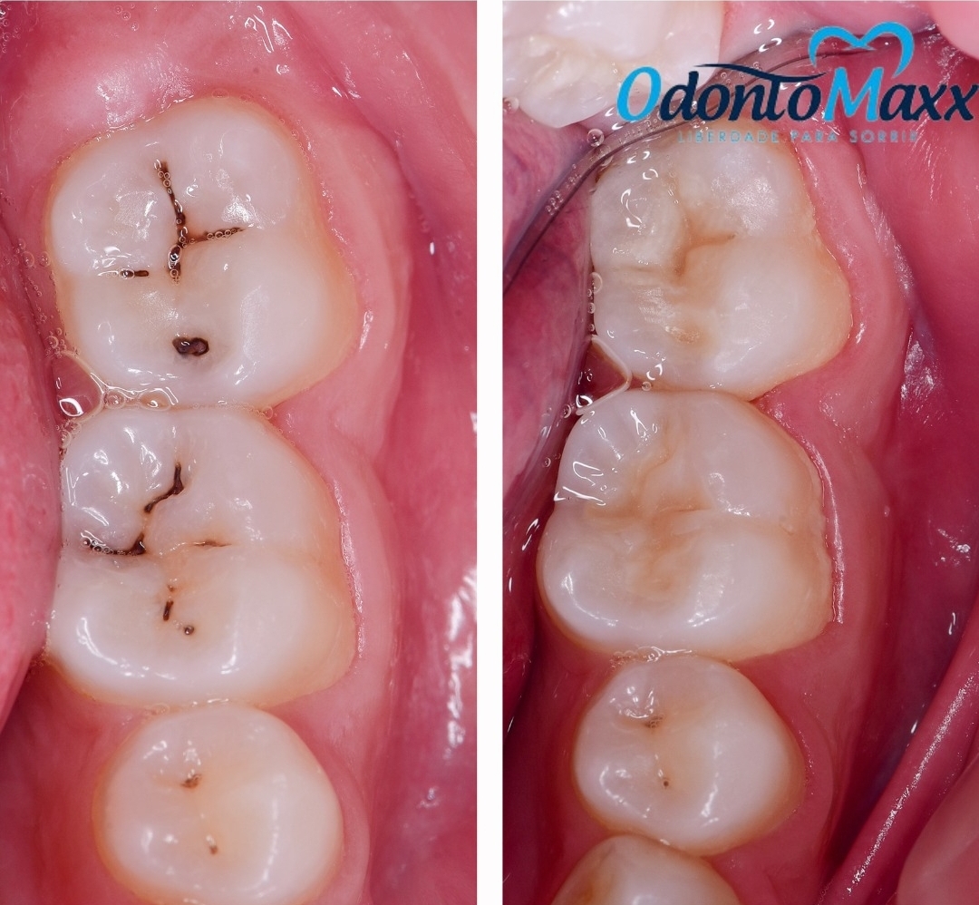 Foto principal de OdontoMaxx Dentistas experientes 
