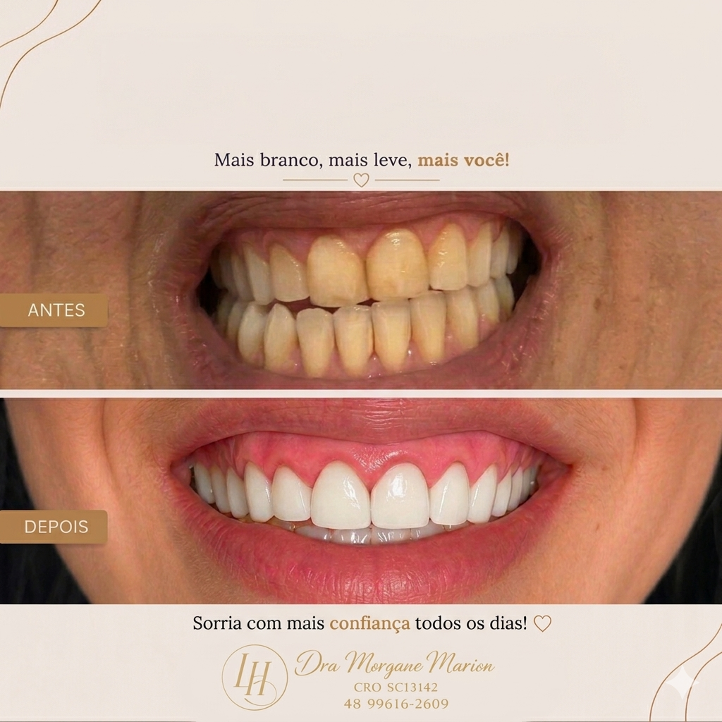 Foto principal de Dentista Dra. Morgane Marion ( Endodontia com Microscopia, Harmonização facial e Alinhadores Invisíveis)