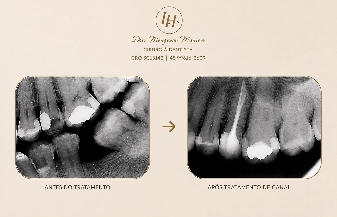 Foto 2 de Dentista Dra. Morgane Marion ( Endodontia com Microscopia, Harmonização facial e Alinhadores Invisíveis)