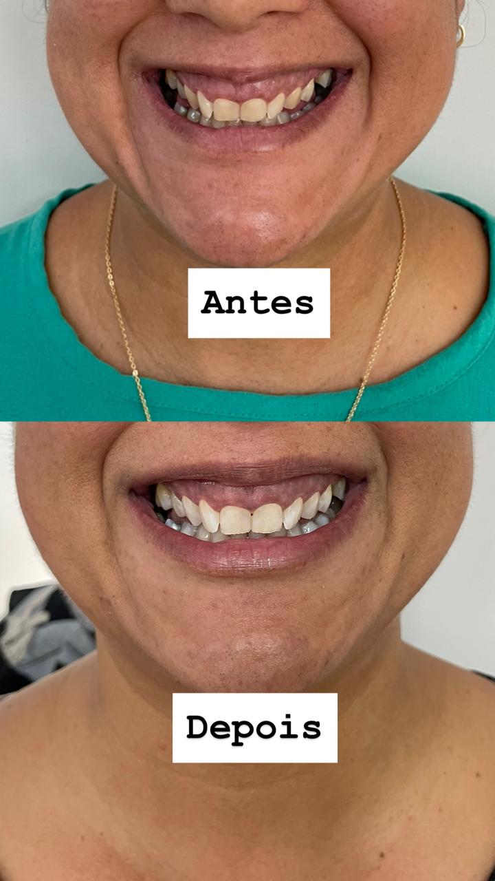 Foto 3 de Dentista em Manaus - Dra. Sara Laís Odontologia especializada