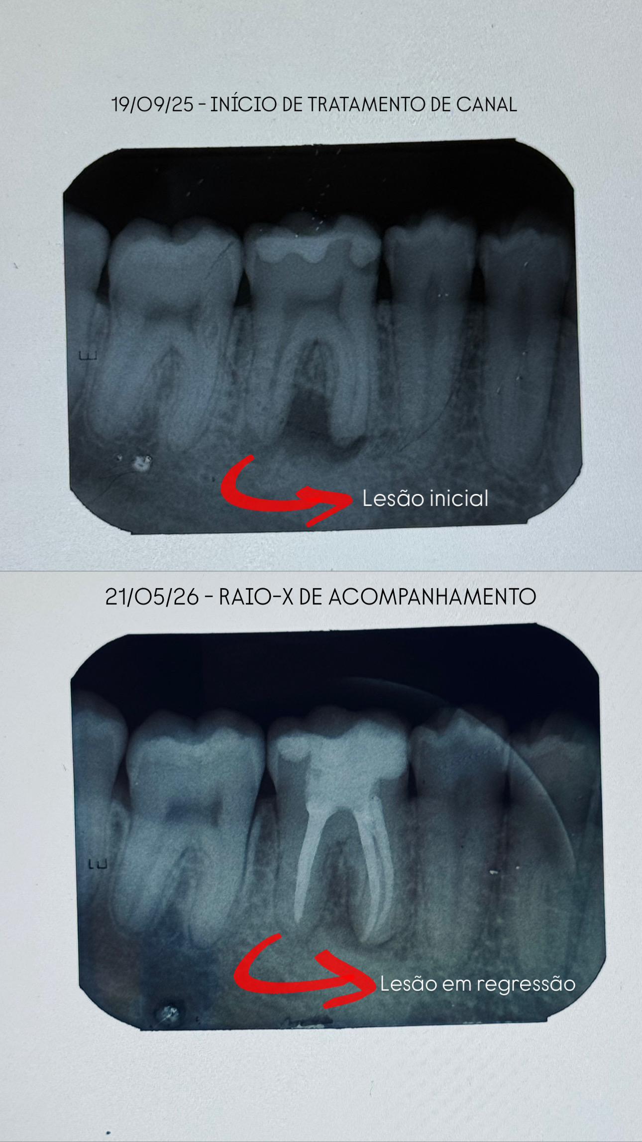 Foto principal de Dentista em João Pessoa - Dra. Bianca Costa | Endodontista e Tratamento de Canal em João Pessoa
