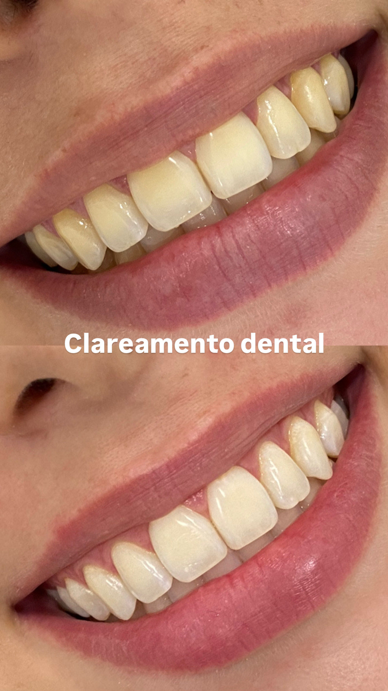 Foto 2 de Dentista em João Pessoa - Dra. Bianca Costa | Endodontista e Tratamento de Canal em João Pessoa