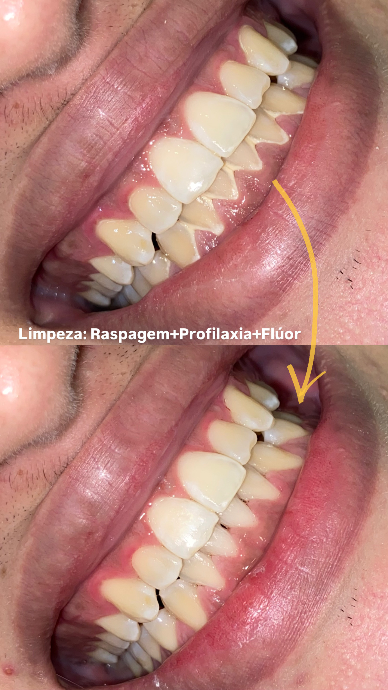 Foto 3 de Dentista em João Pessoa - Dra. Bianca Costa | Endodontista e Tratamento de Canal em João Pessoa
