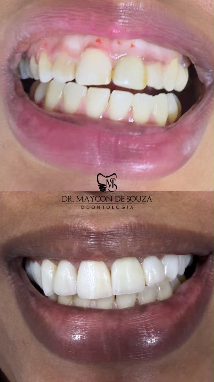 Foto 2 de MS Odontologia Dr Maycon