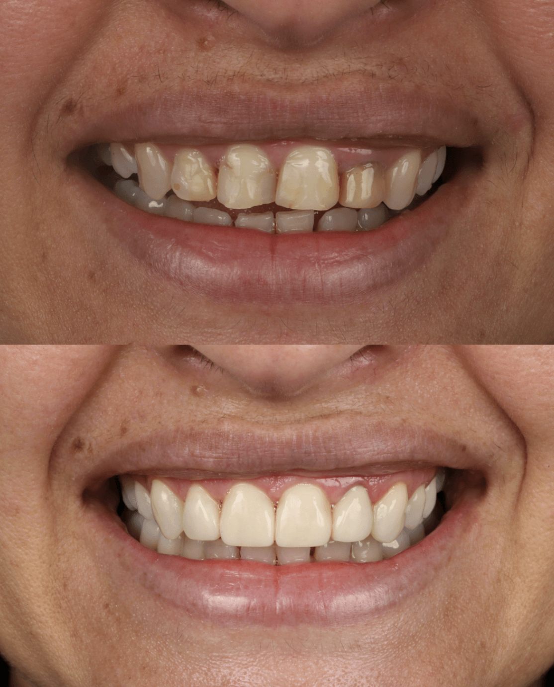 Foto 3 de Dra Raquel Ribas- Invisalign Doctor Brasília