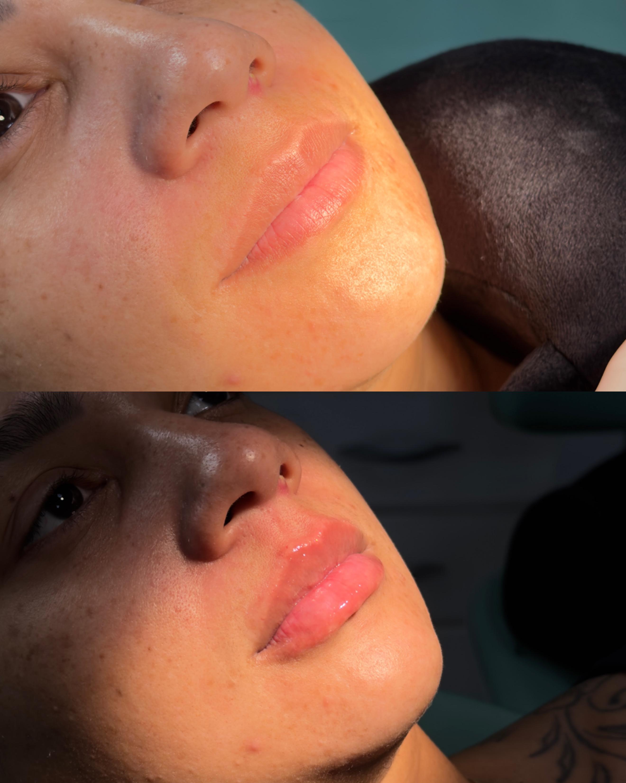 Foto 3 de Dra.Mariha Fernandes Odontologia Estética e Harmonização orofacial