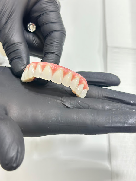 Foto 3 de 3 Fronteiras Odontologia Avançada – Implantes, Facetas, Ortodontia e Harmonização em Foz do Iguaçu