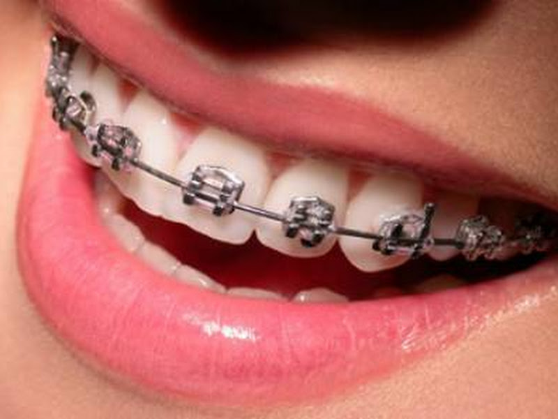 Foto 6 de 4all Odontologia