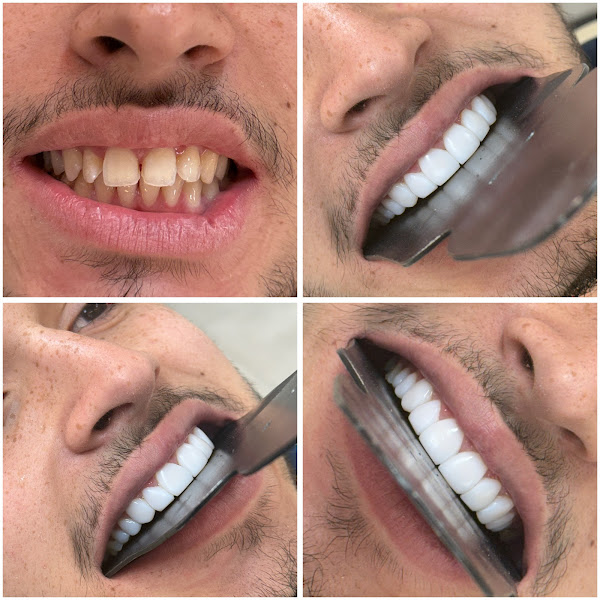 Foto 2 de 4D Clinica odontológica