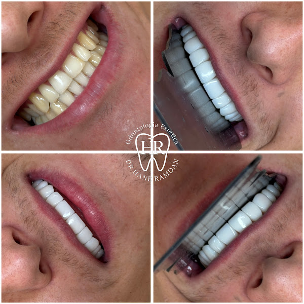 Foto 4 de 4D Clinica odontológica