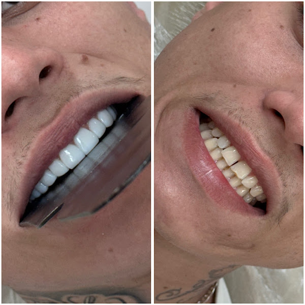 Foto 5 de 4D Clinica odontológica