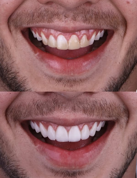 Foto 2 de A&A Dental Institute | Dentista e Facetas em Petrolina