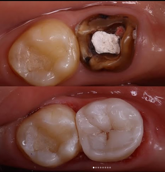 Foto 3 de A&A Dental Institute | Dentista e Facetas em Petrolina