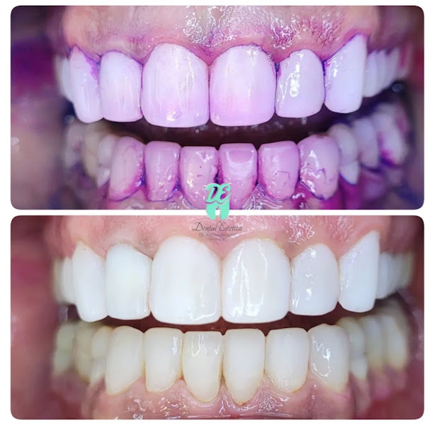 Foto 2 de A melhor clínica de Caraguatatuba - Dental Estética A.R - Mais de 15 mil sorrisos transformados nesses 32 anos!