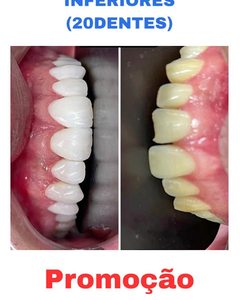 Foto 3 de A Prime Odonto | Dentista em Cariacica | Implantes | Facetas