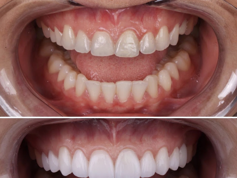 Foto 8 de Á Prime Odontologia LTDA