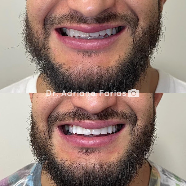 Foto 2 de A1 Implantes | Clínica Odontológica no Valparaíso