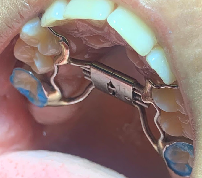 Foto 3 de A1 Implantes | Clínica Odontológica no Valparaíso