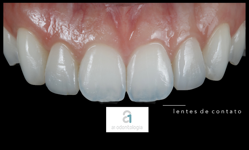 Foto 3 de A1 Odontologia