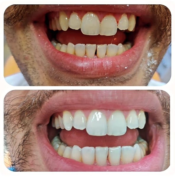 Foto 2 de A2 Facile Clinicas Odontologicas - Unidade Madureira