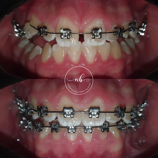Foto 2 de AB. Odontologia - Dentista em Santa Luzia/São Benedito