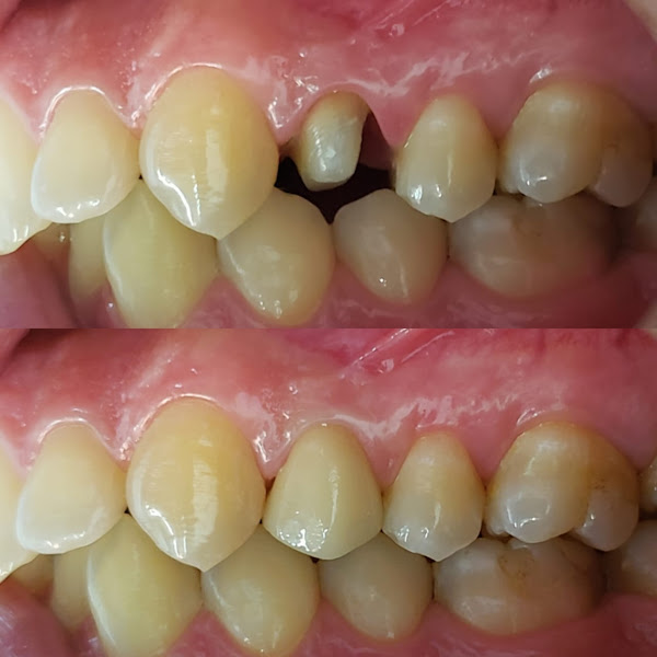 Foto 3 de Abreu e Sendra Odontologia | Dentista Méier | Ortodontia | Prótese | Implante | Cirurgião Bucomaxilo Facial | Facetas