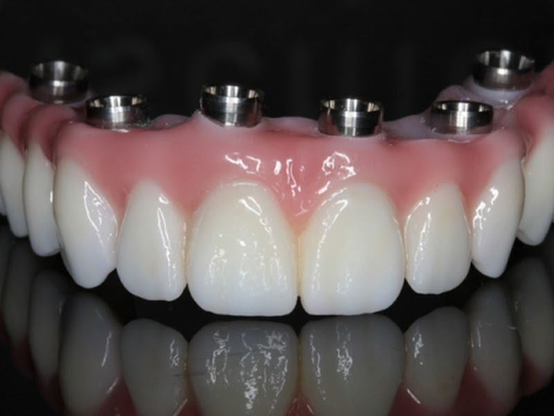 Foto 8 de Ac Odontologia Especializada