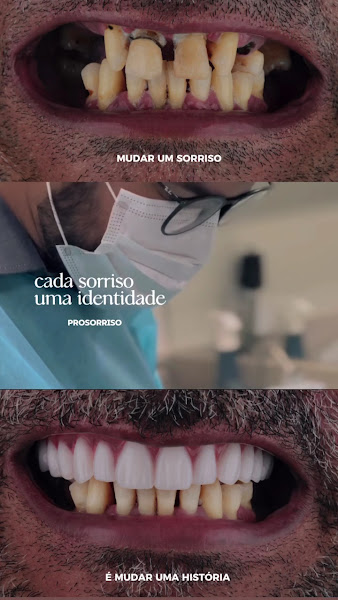 Foto 4 de ACM Odontologia Sobradinho - Implante dentário, Facetas, Lente de contato dental
