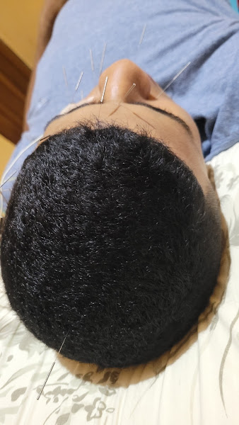 Foto 3 de Acupuntura Dr: Nilzete Oliveira