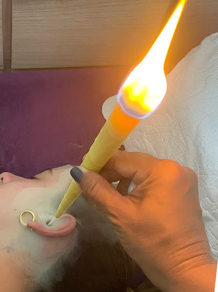 Foto 3 de Acupuntura e estética Lud Freitas