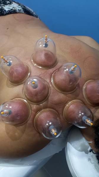 Foto 3 de Acupuntura Karina Revigora Terapias Alternativas Milenares @karinarevigora