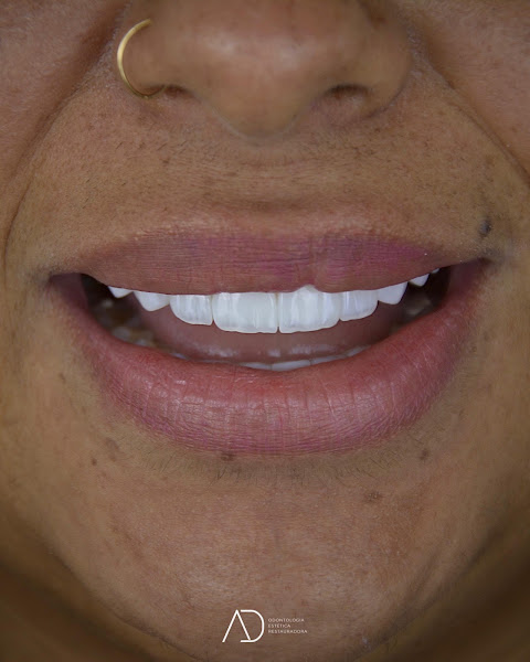 Foto 2 de AD Odontologia Estética Restauradora - Dr. Adson Oliveira