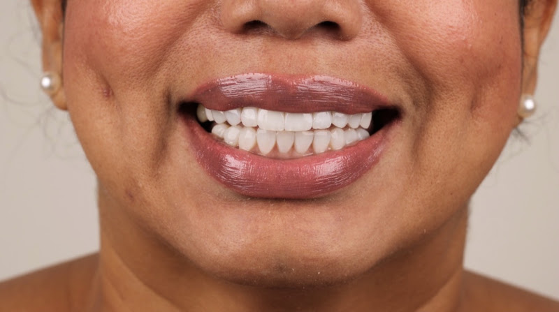 Foto 3 de AD Odontologia Estética Restauradora - Dr. Adson Oliveira