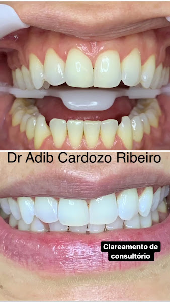 Foto 3 de Adib Odontologia Consultorio Odontológico Dr: Adib Cardozo Ribeiro