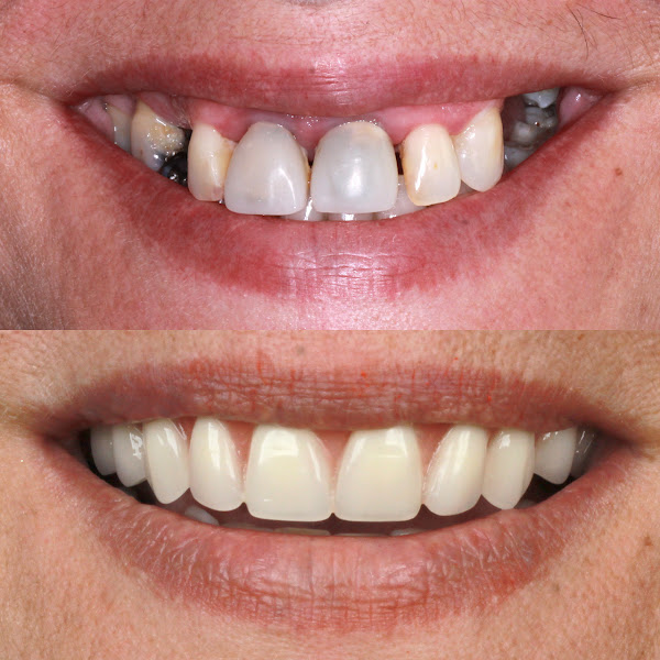 Foto 3 de Adora Odontologia - implantes dentários