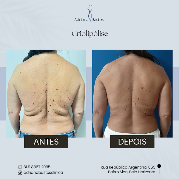 Foto 4 de ADRIANA BASTOS - CLÍNICA DE ESTÉTICA