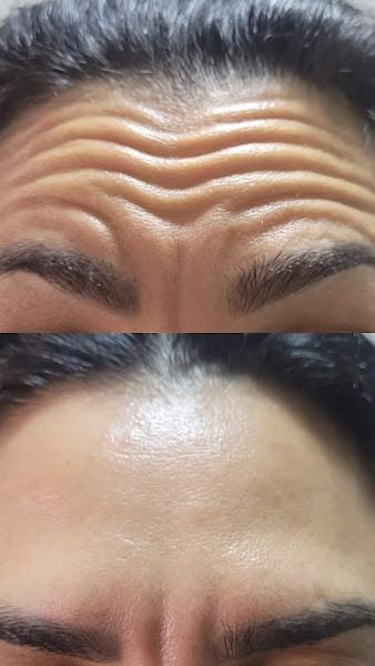 Foto 2 de Afrodith | Estética Facial e Corporal - Clínica em Cascavel