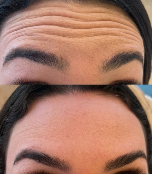 Foto 3 de Afrodith | Estética Facial e Corporal - Clínica em Cascavel