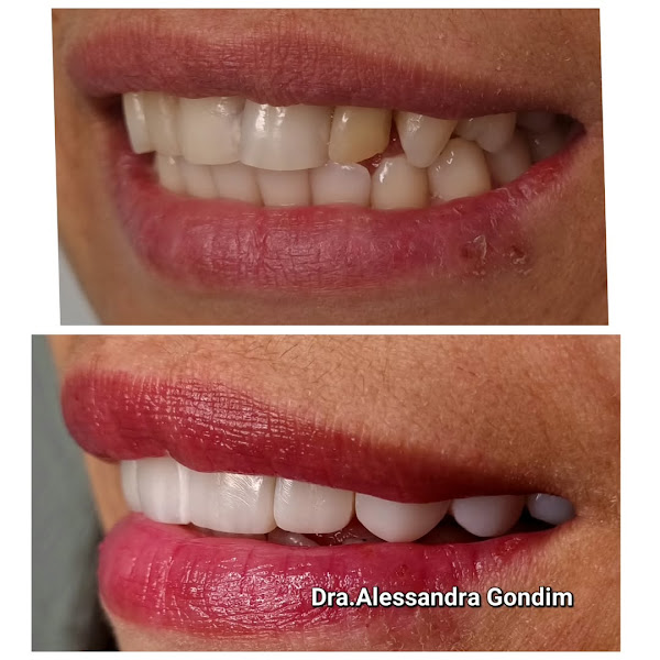 Foto 3 de AG Odontologia Dra Alessandra Gondim