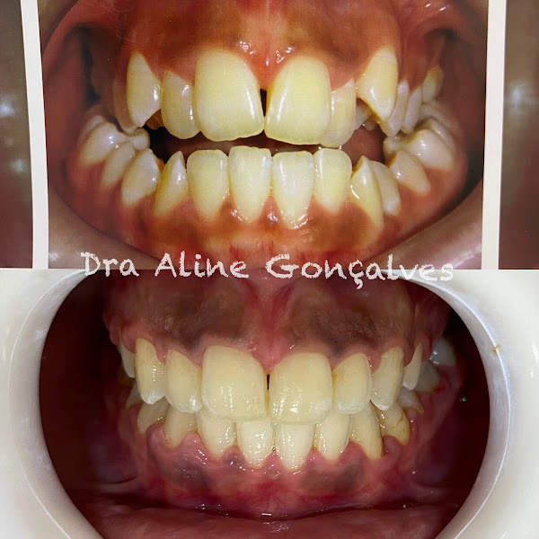 Foto 2 de AG Odontologia e Harmonização Facial