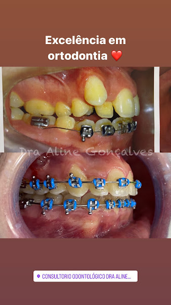 Foto 3 de AG Odontologia e Harmonização Facial
