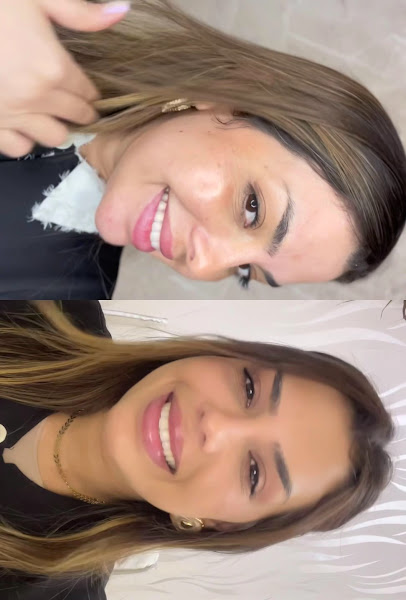 Foto 3 de Ageless Medicina Estética | Botox|Bioestimuladores|Preenchimentos faciais| Full face|